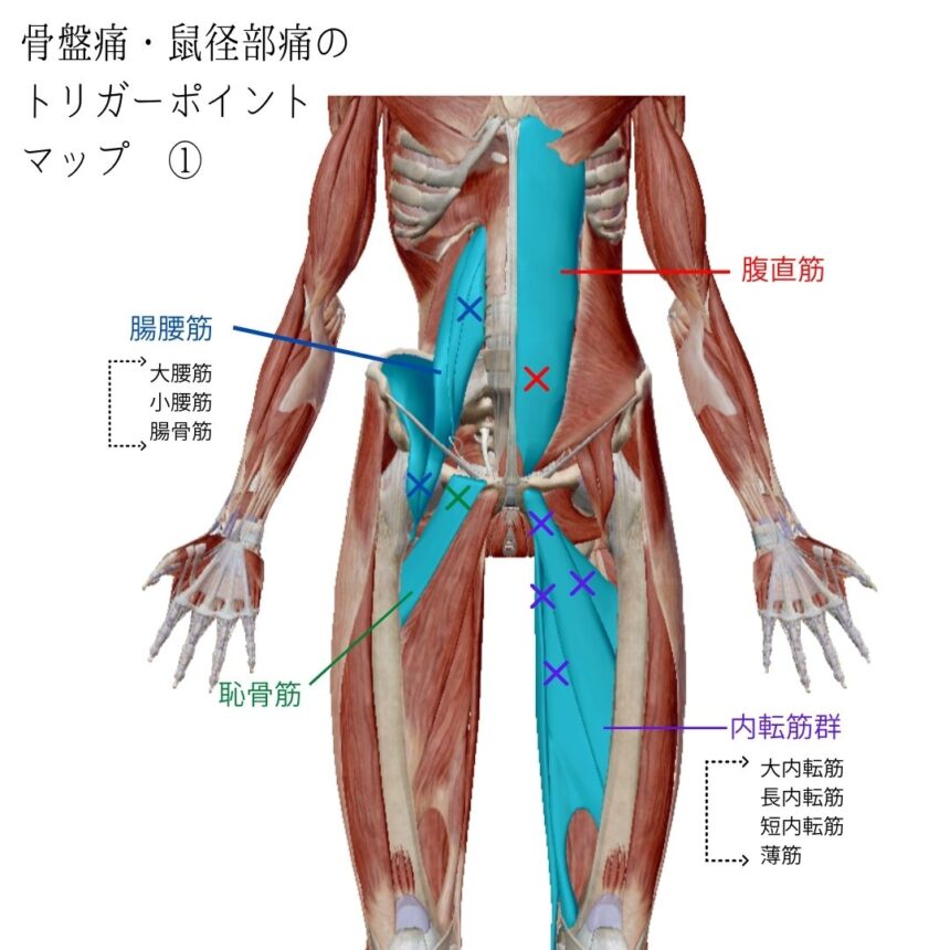 生理前の腰痛・骨盤痛のトリガーポイント①