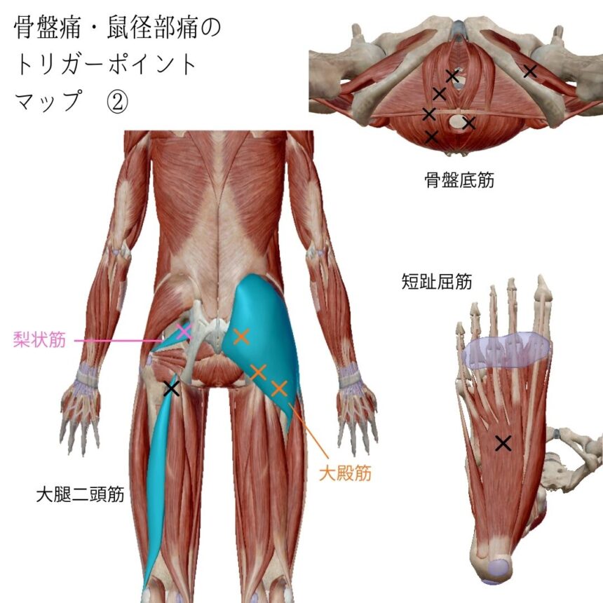 生理前の腰痛・骨盤痛のトリガーポイント②