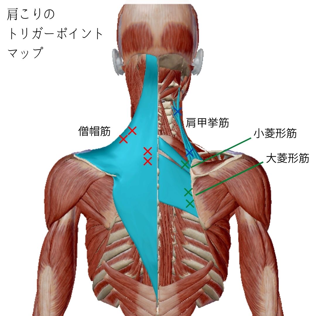 肩こりトリガーポイントマップ1